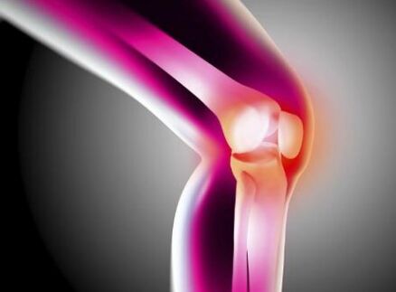 Arthrosis deformálása