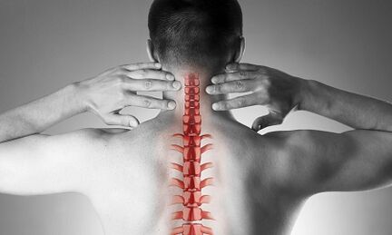 Hogyan nyilvánul meg a nyaki gerinc osteochondrosis